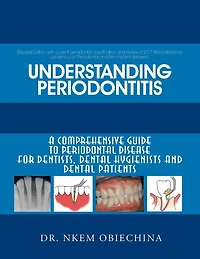 Understanding Periodontitis: A Comprehensive Guide to Periodontal Disease for Dentists, Dental Hygienists and Patients