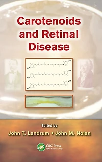 Carotenoids and Retinal Disease