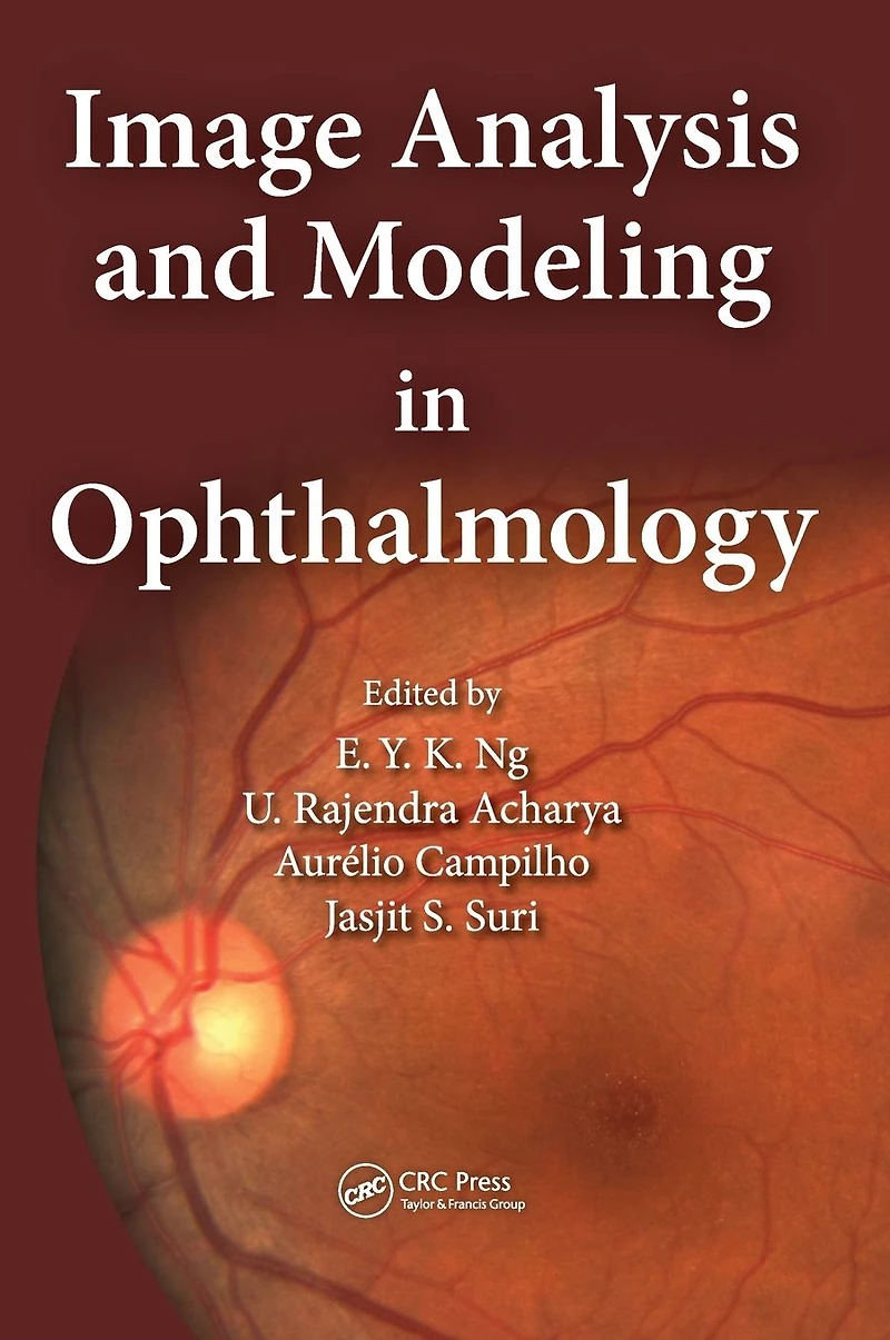 Image Analysis and Modeling Ophthalmology