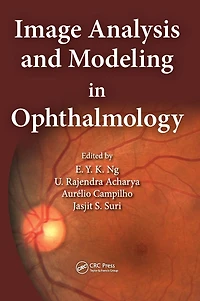 Image Analysis and Modeling Ophthalmology
