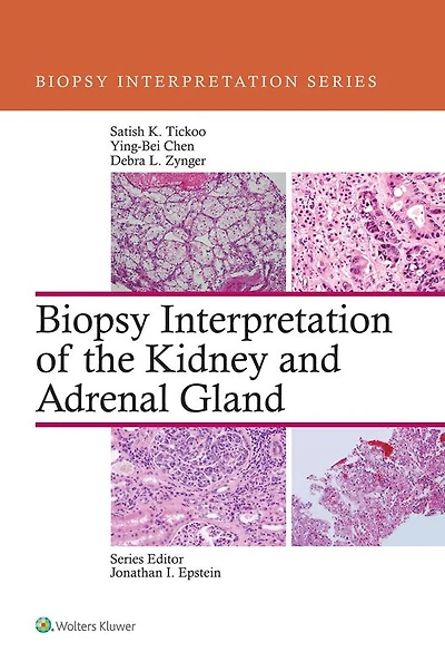 Biopsy Interpretation of the Kidney & Adrenal Gland