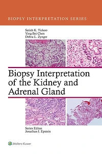 Biopsy Interpretation of the Kidney & Adrenal Gland