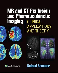 MR and CT Perfusion and Pharmacokinetic Imaging: Clinical Applications and Theoretical Principles