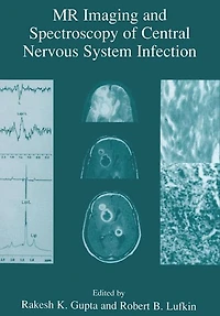 MR Imaging and Spectroscopy of Central Nervous System Infection