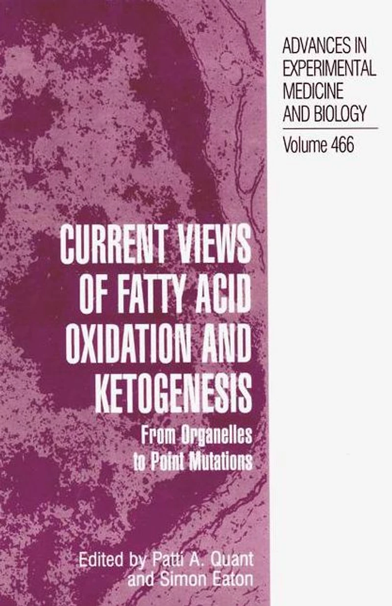 Current Views of Fatty Acid Oxidation and Ketogenesis: From Organelles to Point Mutations