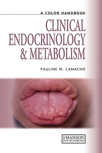 Clinical Endocrinology and Metabolism