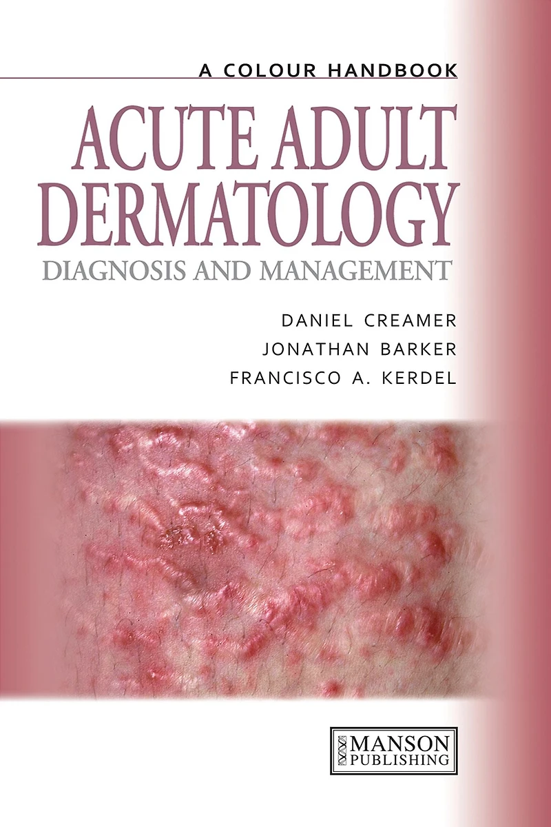 Acute Adult Dermatology: Diagnosis and Management: A Colour Handbook