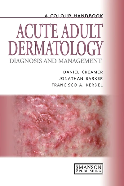 Acute Adult Dermatology: Diagnosis and Management: A Colour Handbook