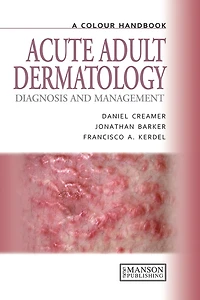 Acute Adult Dermatology: Diagnosis and Management: A Colour Handbook