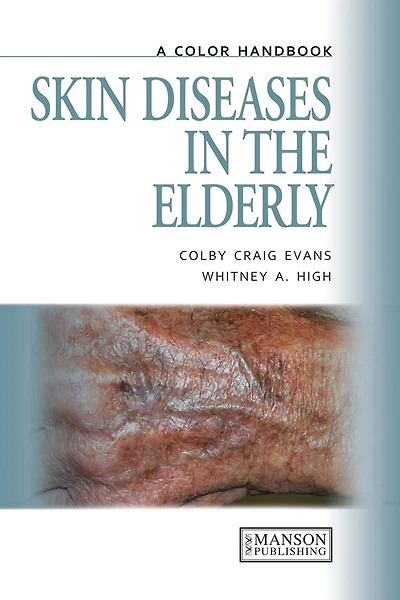 Skin Diseases in the Elderly: A Color Handbook