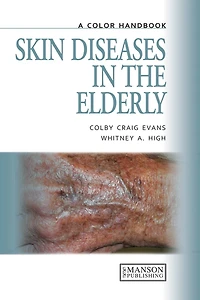Skin Diseases in the Elderly: A Color Handbook