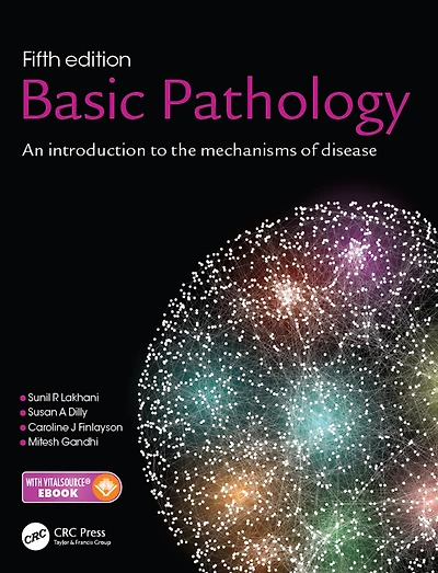 Basic Pathology: An introduction to the mechanisms of disease