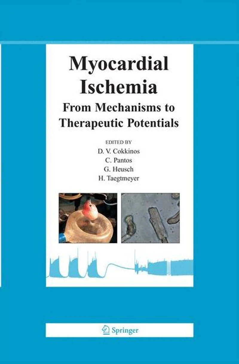 Myocardial Ischemia: From Mechanisms to Therapeutic Potentials