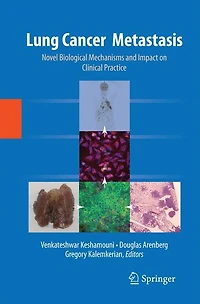 Lung Cancer Metastasis: Novel Biological Mechanisms and Impact on Clinical Practice