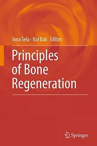 Principles of Bone Regeneration