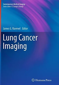 Lung Cancer Imaging