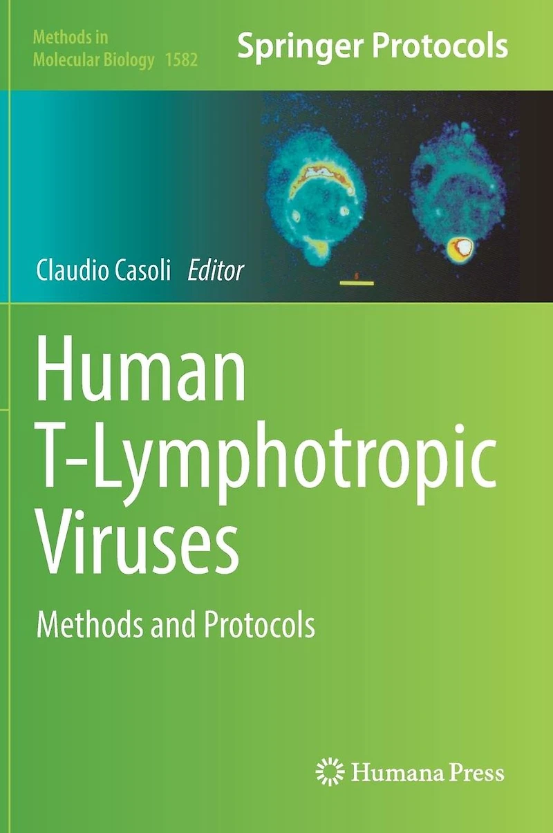 Human T-Lymphotropic Viruses: Methods and Protocols
