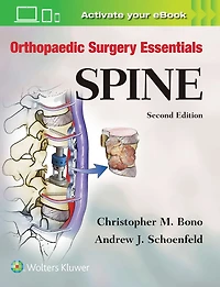 Orthopaedic Surgery Essentials: Spine