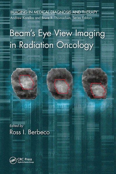 Beam's Eye View Imaging Radiation Oncology