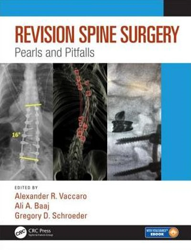 Revision Spine Surgery: Pearls and Pitfalls