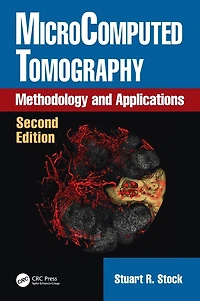 MicroComputed Tomography: Methodology and Applications, Second Edition