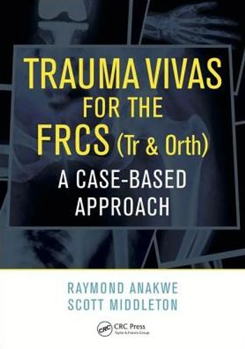 Trauma Vivas for the FRCS: A Case-Based Approach