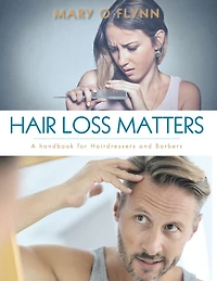 Hair Loss Matters: A Handbook for Hairdressers and Barbers