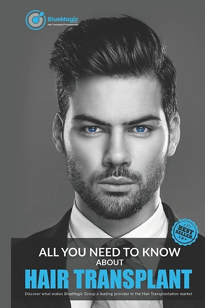 All You Need to Know about Hair Transplant: Best Hair Transplant in Turkey- Discover what makes BlueMagic Group a leading provider in the Hair Transplantation market