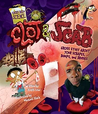 Clot & Scab: Gross Stuff about Your Scrapes, Bumps, and Bruises