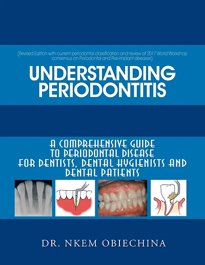 Understanding Periodontitis: A Comprehensive Guide to Periodontal Disease for Dentists, Dental Hygienists and Patients