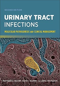 Urinary Tract Infections: Molecular Pathogenesis and Clinical Management