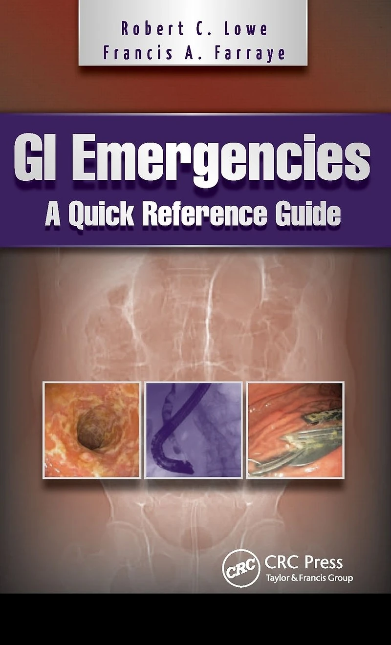 GI Emergencies: A Quick Reference Guide