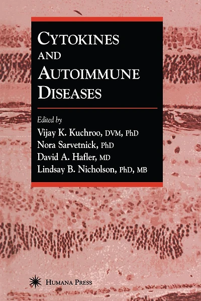 Cytokines and Autoimmune Diseases