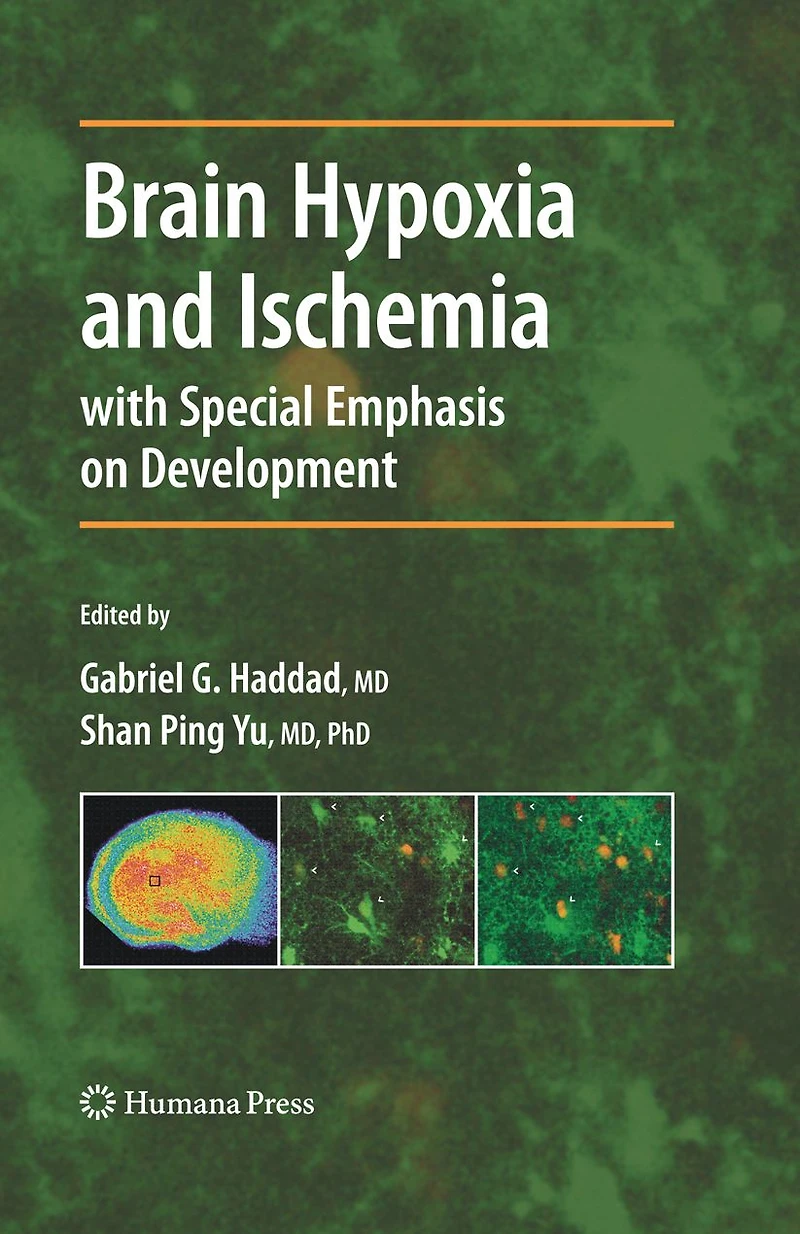 Brain Hypoxia and Ischemia