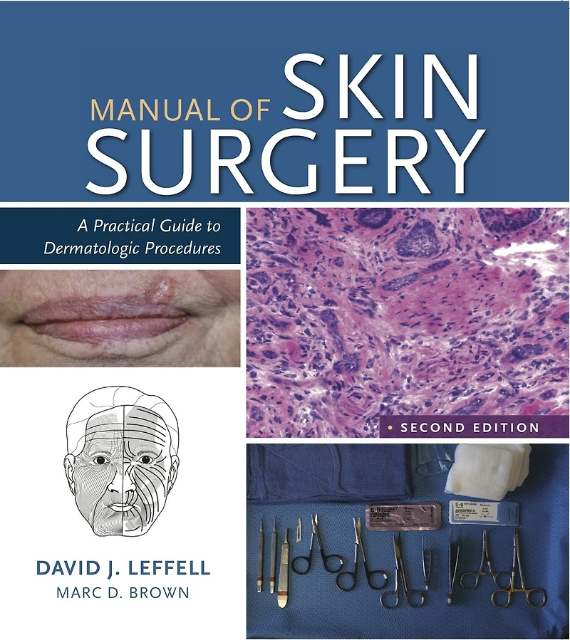 Manual of Skin Surgery: A Practical Guide to Dermatologic Procedures