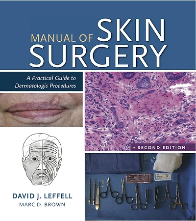 Manual of Skin Surgery: A Practical Guide to Dermatologic Procedures
