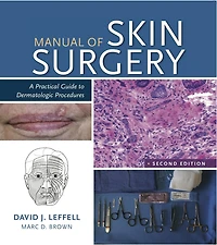 Manual of Skin Surgery: A Practical Guide to Dermatologic Procedures