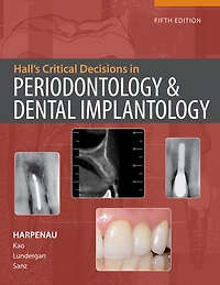 Hall's Critical Decisions in Periodontology & Dental Implantology, 5e