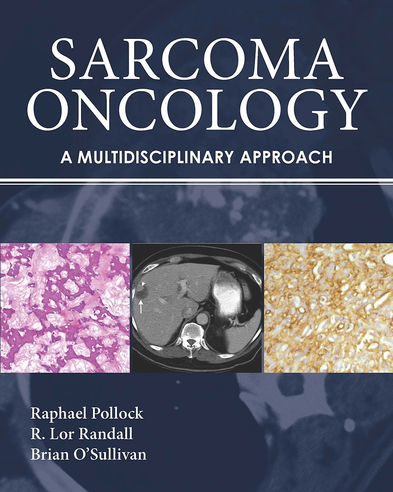 Sarcoma Oncology: A Multidisciplinary Approach