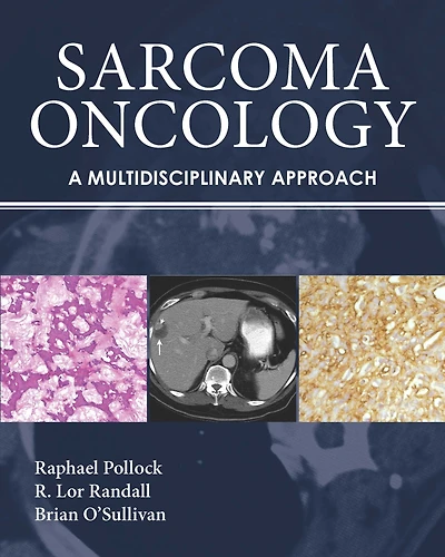Sarcoma Oncology: A Multidisciplinary Approach