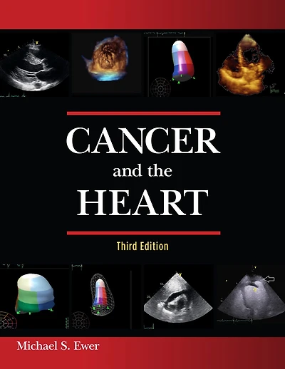 Cancer and the Heart