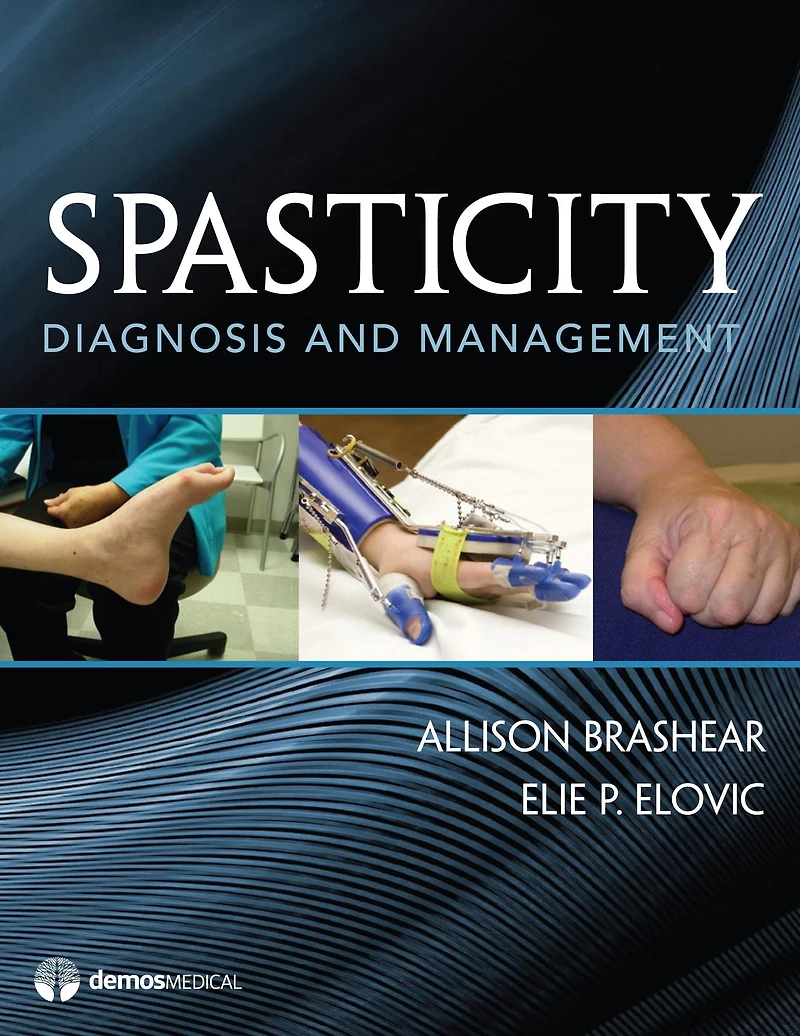 Spasticity: Diagnosis and Management