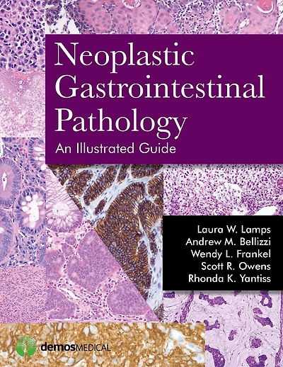 Neoplastic Gastrointestinal Pathology: An Illustrated Guide