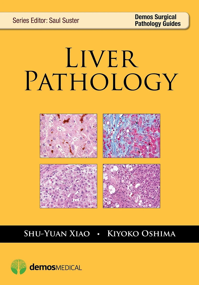 Liver Pathology
