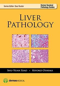 Liver Pathology