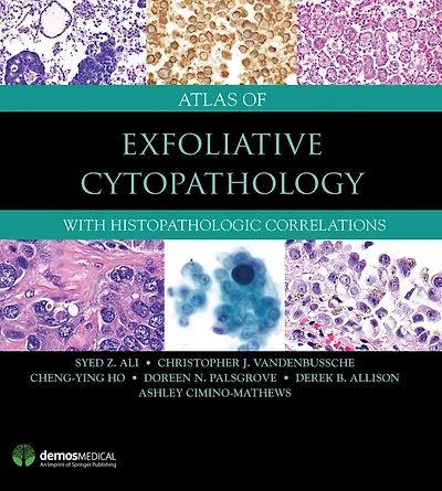 Atlas of Exfoliative Cytopathology: With Histopathologic Correlations