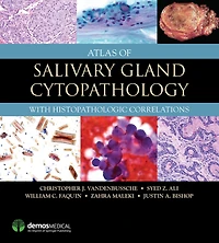 Atlas of Salivary Gland Cytopathology: with Histopathologic Correlations
