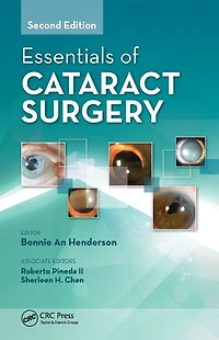 Essentials of Cataract Surgery