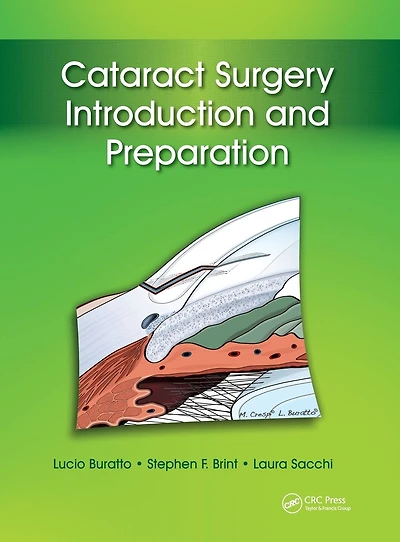 Cataract Surgery: Introduction and Preparation