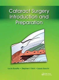 Cataract Surgery: Introduction and Preparation